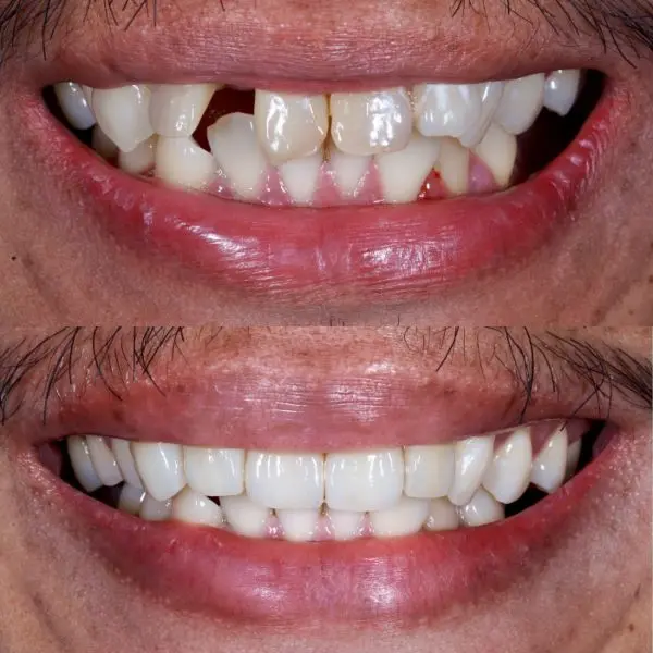 1537674140-1537674140-1