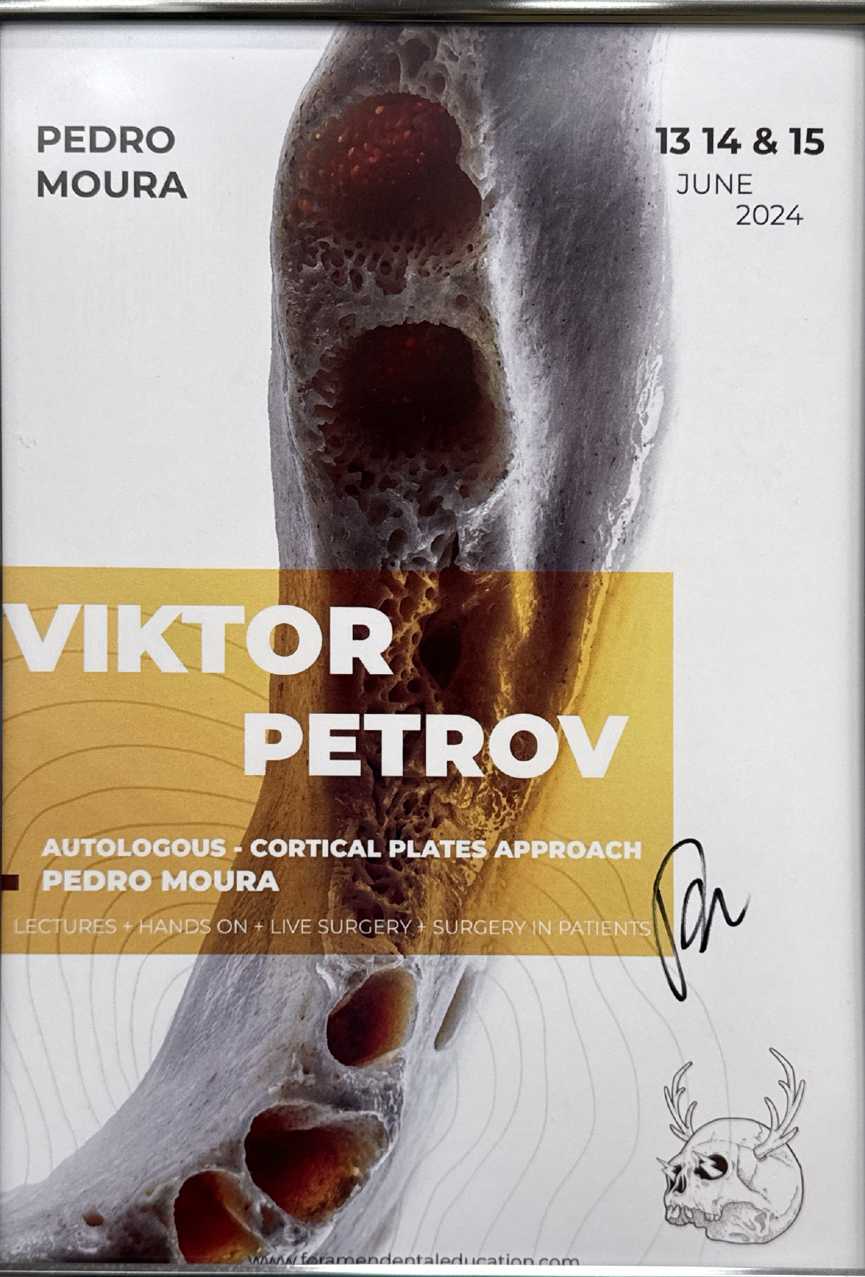 Procédures d'augmentation partie II Dr Viktor Petrov