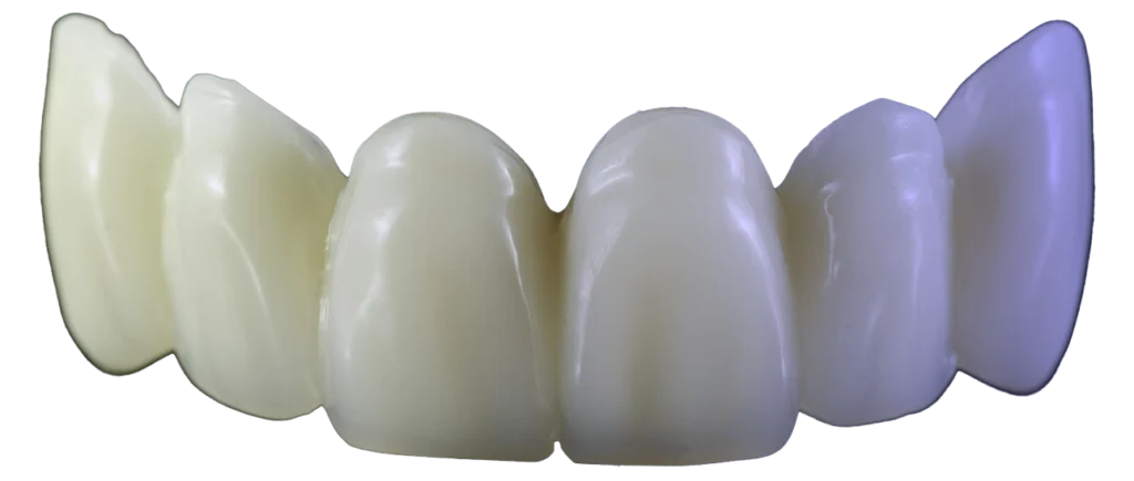 crown and bridges Antwerp