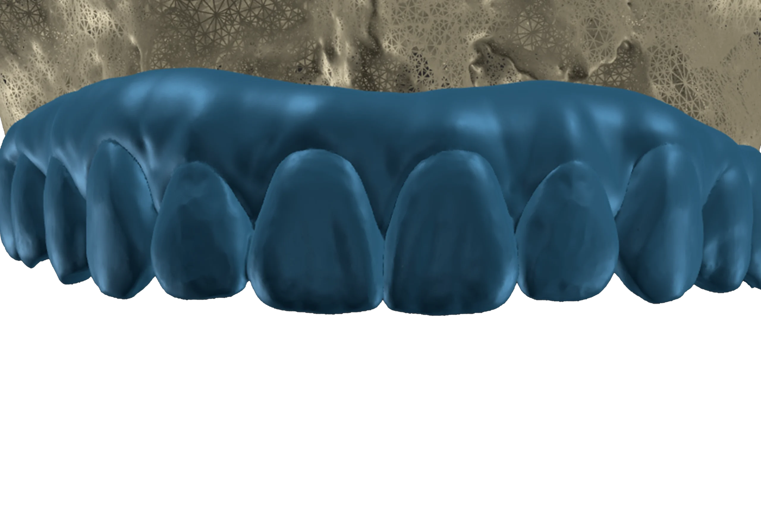 Digitaal smile design bij VIDENT Antwerpen – software voor planning op basis van gezichtsproporties