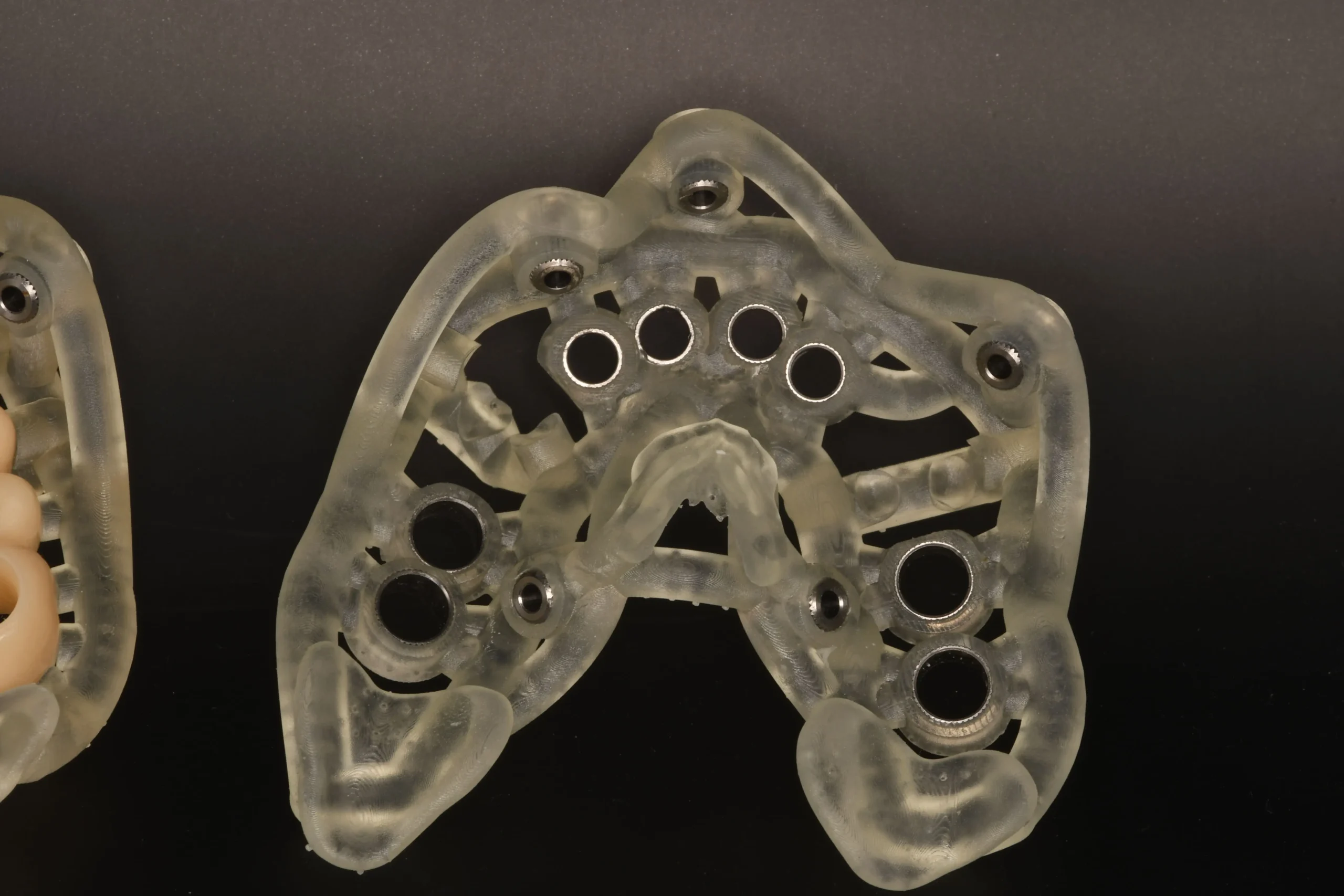 Surgical guide used for precise dental implant placement at VIDENT Antwerp